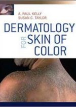 Dermatology for Skin of Color **