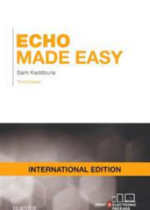 Echo Made Easy IE, 3rd Edition