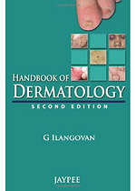 Handbook of Dermatology 2E