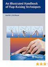 An Illustrated Handbook of Flap-Raising Techniques