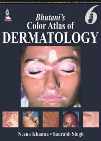 Bhutani’s Color Atlas of Dermatology 6/e