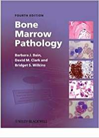 Bone Marrow Pathology Fife