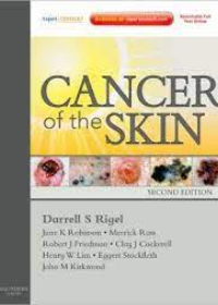 Cancer of the Skin, 2e **