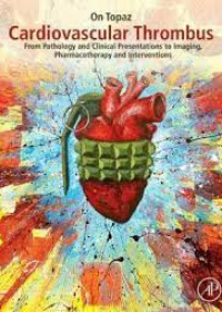 Cardiovascular Thrombus : From Pathology and Clinical Presentations to Imaging, Pharmacotherapy and Interventions