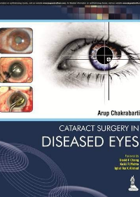 Cataract Surgery in Diseased Eyes