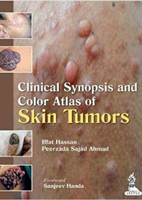 Clinical Synopsis and Color Atlas of Skin Tumors