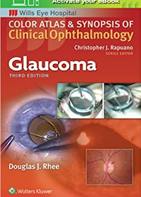 Color Atlas and Synopsis of Clinical Ophthalmology: Glaucoma 3e