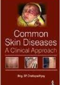 Common Skin Diseases: A Clinical Approach