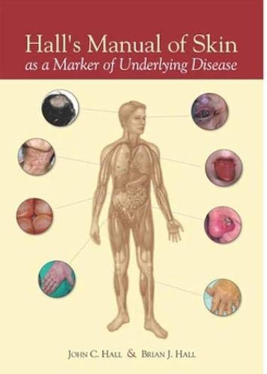 Hall's Manual of Skin: As A Marker of Underlying Disease